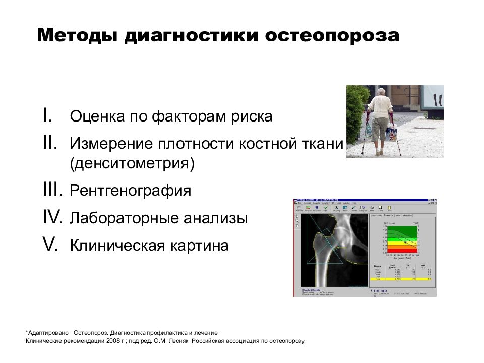 Лечение остеопороза методы