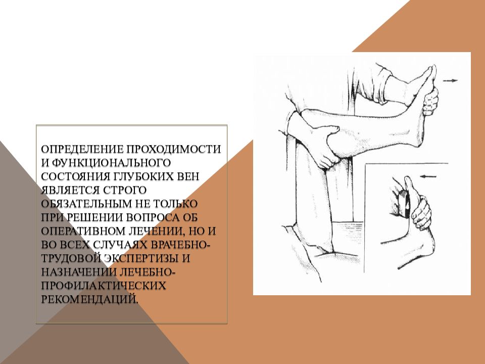 Методы определения проходимости глубоких вен. Проба Мейо-Пратта. Для определения проходимости глубоких вен применяют пробу.