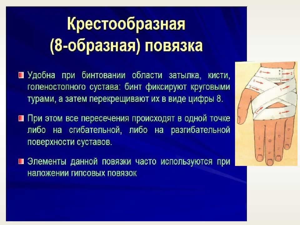 Десмургия виды повязок презентация