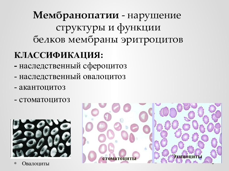 Нарушение структуры. Мембранопатия анемия. Мембранопатии эритроцитов. Функции белков мембраны эритроцитов. При наследственном сфероцитозе у эритроцитов.