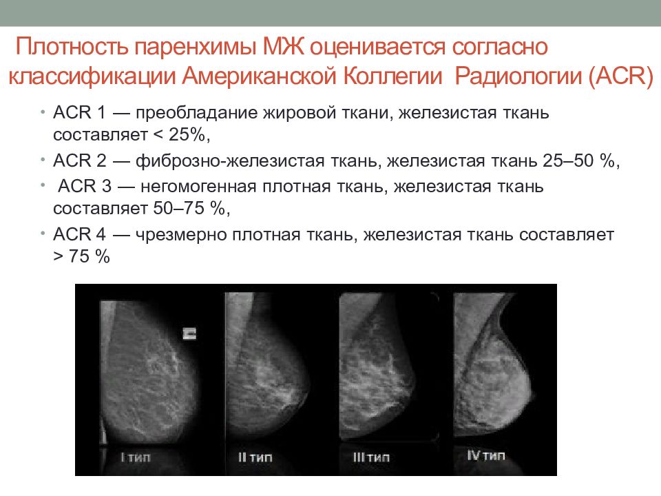 Диагнозы молочных желез