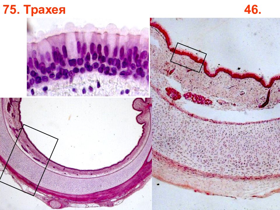 Обучение гистологии. Зиматкин гистология. Трахея гистология препарат. Трахея под микроскопом. Эмбриология гистологические препараты.