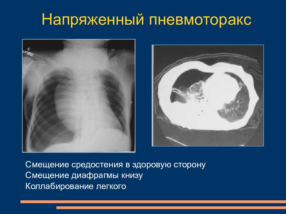 Лучевая диагностика органов средостения презентация