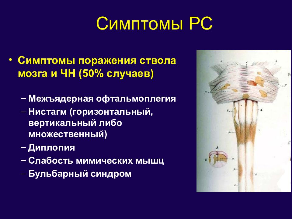 Демиелинизирующие заболевания презентация