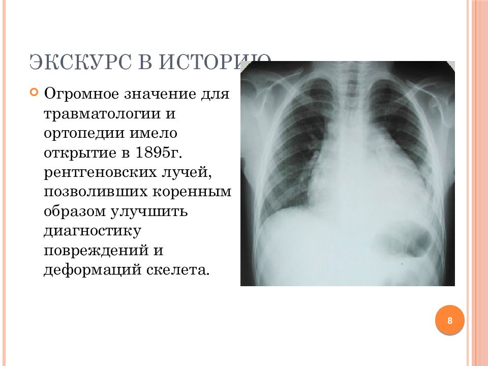 Физиотерапия в травматологии презентация