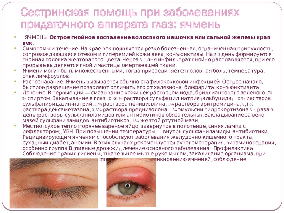 Ячмень на глазу чем лечить народные средства. Заболевания век офтальмология. Заболевания придаточного аппарата глаза.