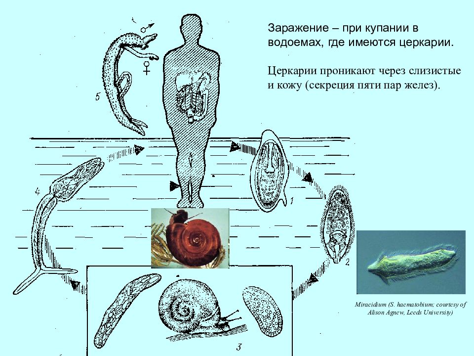 Церкария что это. Церкарий трематод. Паразиты церкарии черви церкарии. Церкария шистосомы строение.