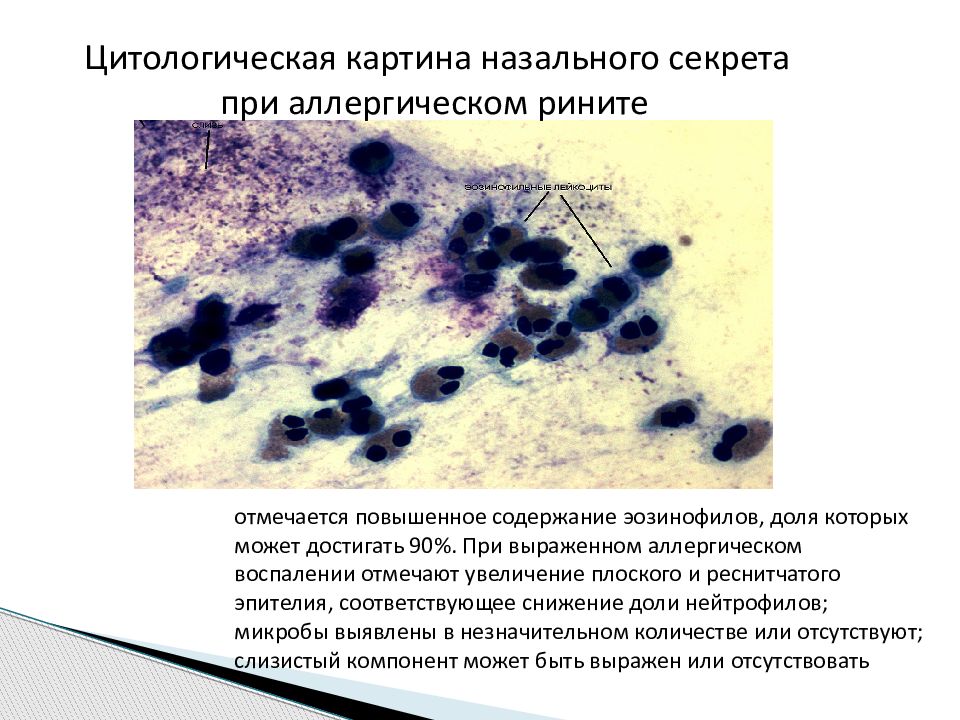 Цитологическая картина воспаления