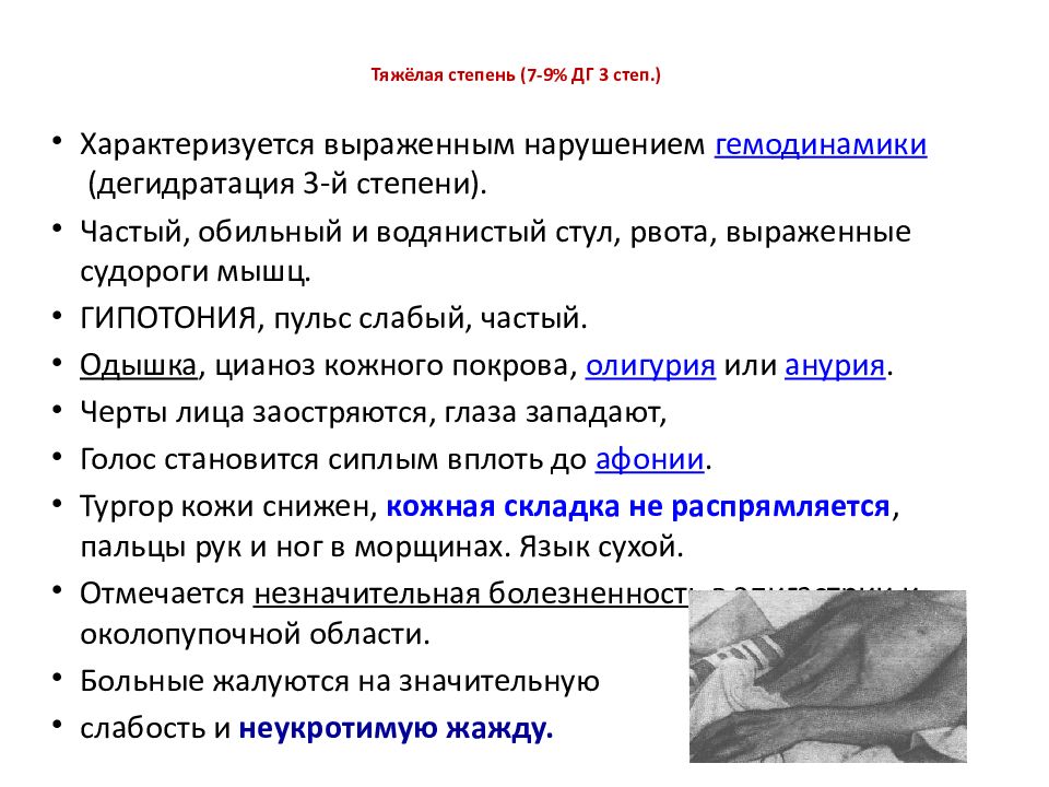 Х о л е р а