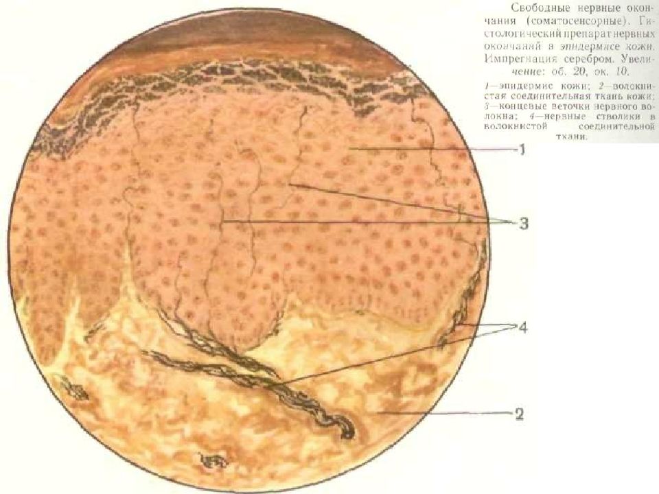 Нервные окончания. Нервные окончания гистология препарат. Свободные нервные окончания в эпителии кожи. Свободные нервные окончания гистология. Свободные нервные окончания в эпителии препарат.