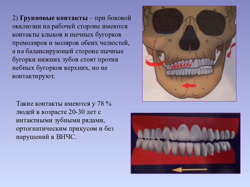 Прикус и окклюзионные контакты зубов презентация