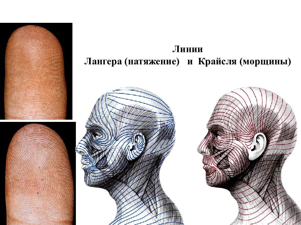 Линии лангера на лице схема