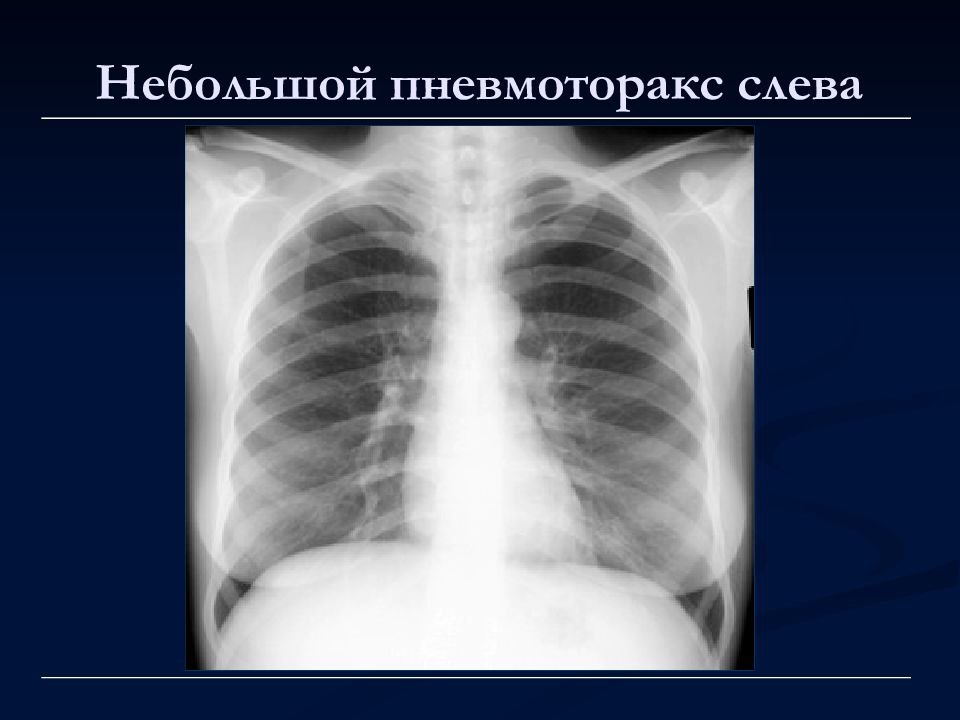 Лучевая диагностика органов дыхания презентация