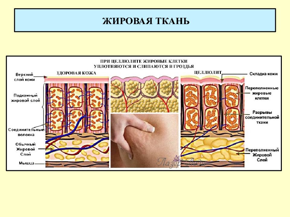 Жировая ткань картинка