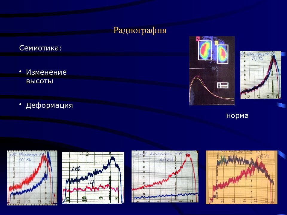 Радиография