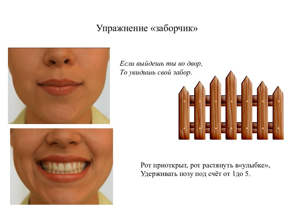 Заборчик артикуляционная гимнастика картинка