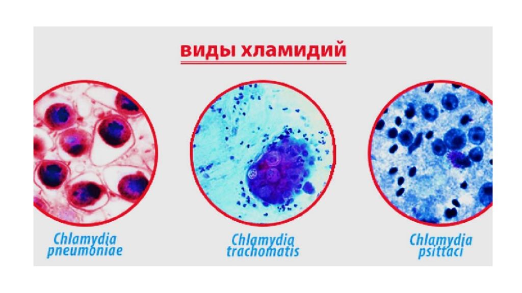 Хламидия chlamydia. Хламидии форма бактерии. Хламидии trachomatis микробиология. Хламидии морфология микробиология. Хламидии микробиология заболевания.