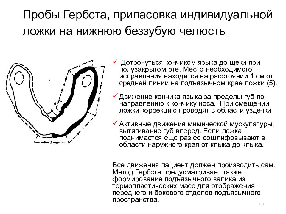 Индивидуальная проба. Пробы Гербста на нижней челюсти. Слепки. Функциональные пробы Гербст. Пробы Гербста на верхней челюсти. Функциональные пробы по Гербсту для верхней челюсти.