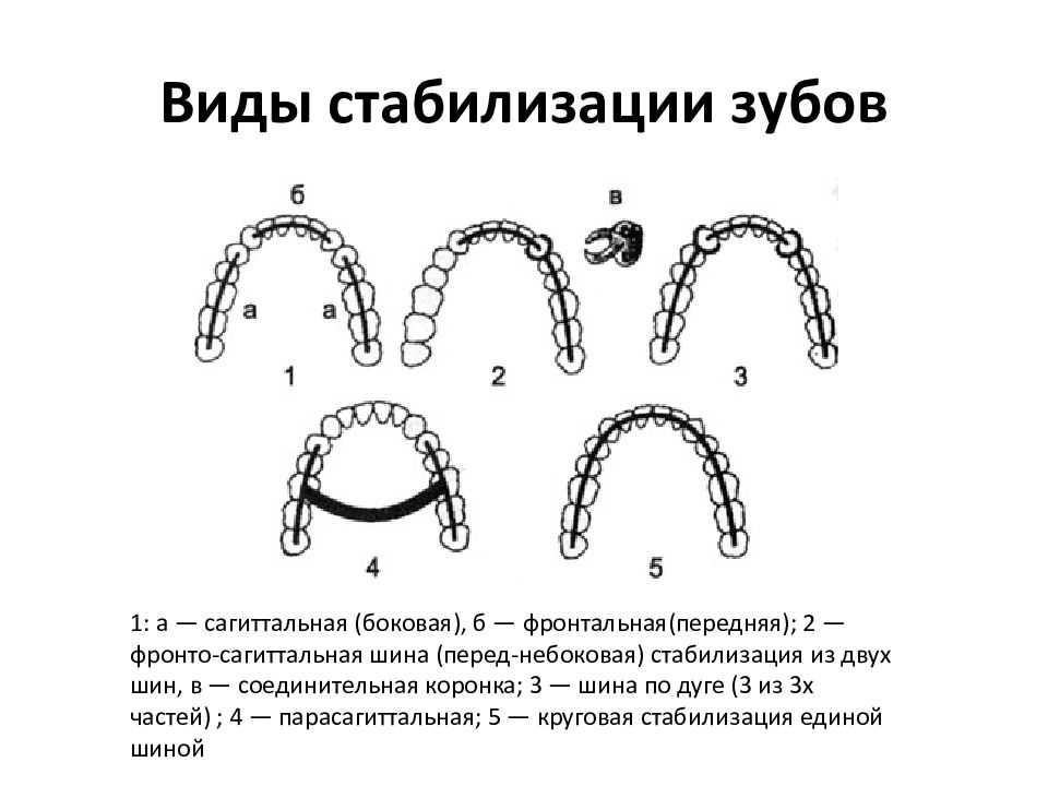 Виды стабилизации зубного ряда. Иммедиат протезы презентация. Методика наложения иммедиат-протезов.