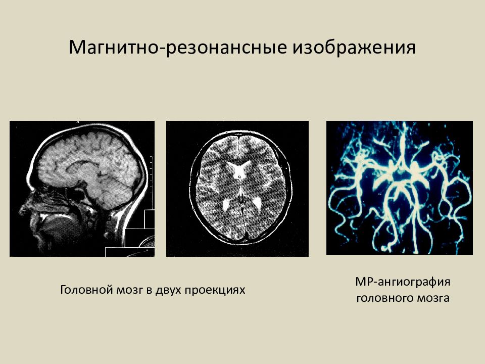 Лучевая диагностика нервной системы презентация