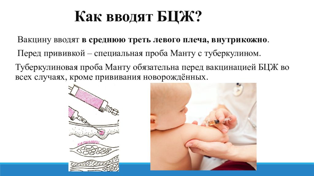 Делают ли прививки бцж. Метод введения вакцины БЦЖ. Техника вакцинации БЦЖ - М. Туберкулез вакцинация БЦЖ.