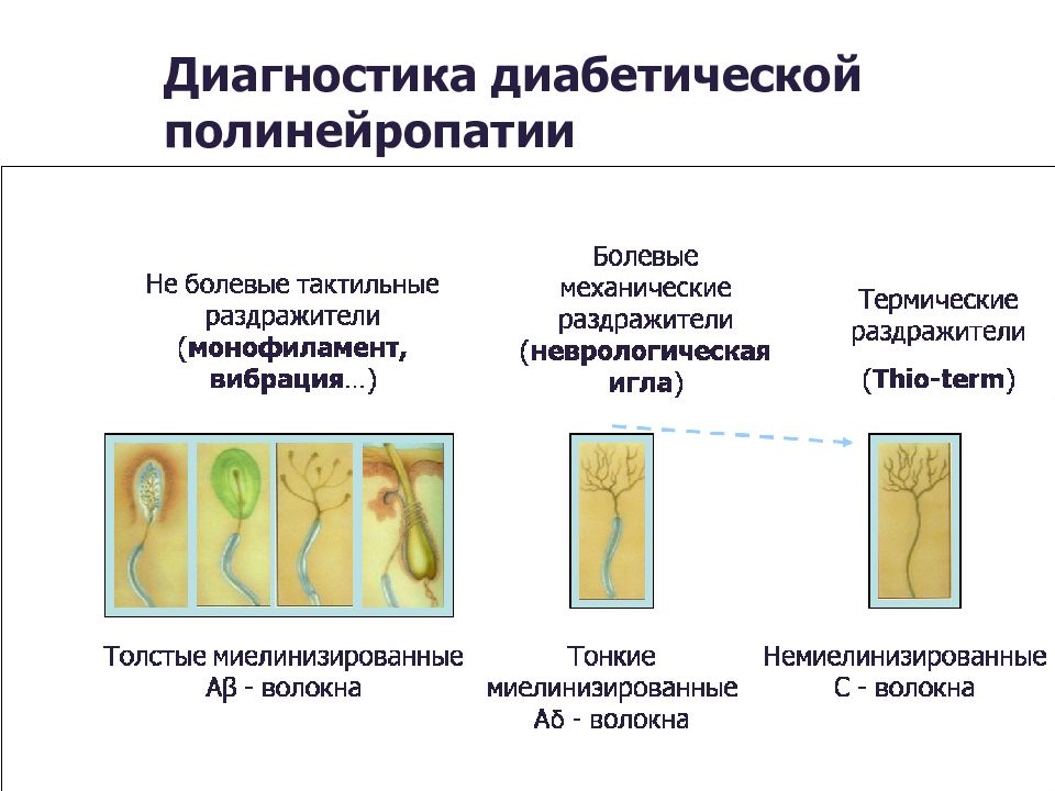 Алкогольная полинейропатия карта вызова