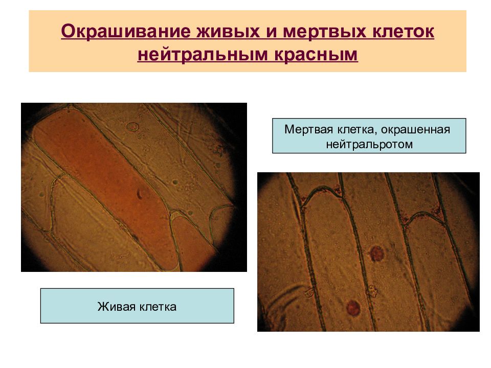 Мертвые и живые клетки растений. Окрашивание живых и мертвых клеток нейтральным красным. Прижизненное окрашивание клеток нейтральным красным. Метод прижизненной окраски. Методы прижизненного окрашивания клеток.