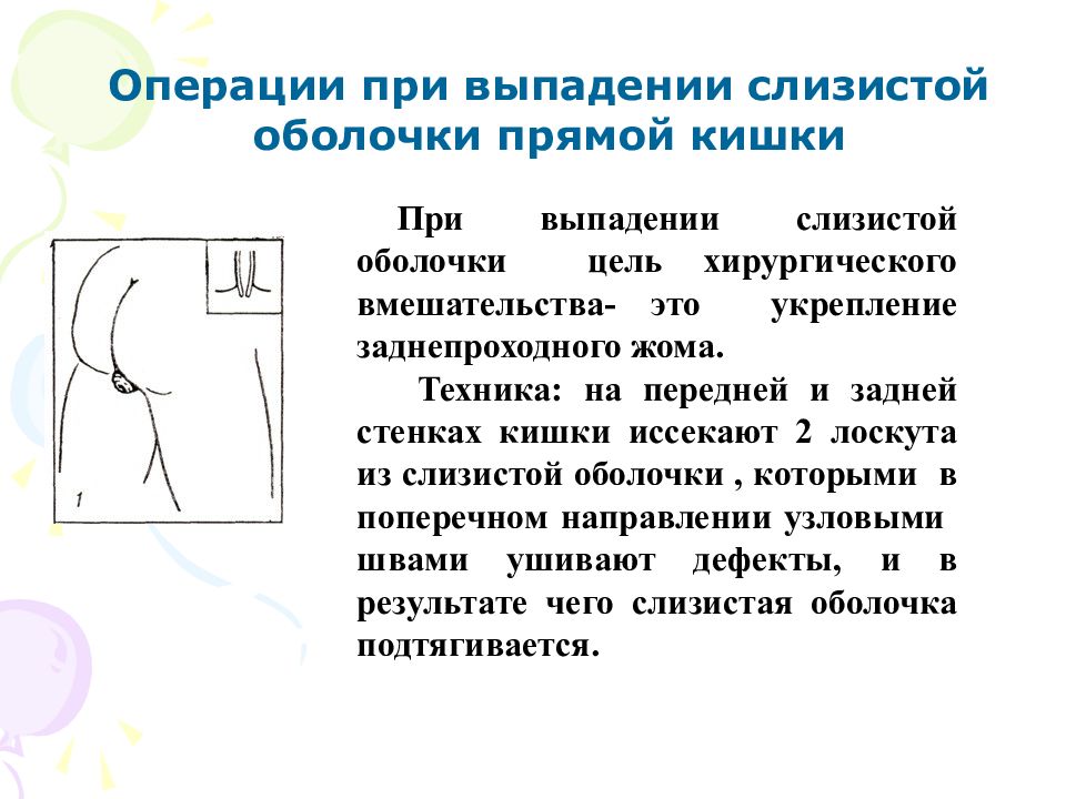 Выпадение прямой кишки презентация