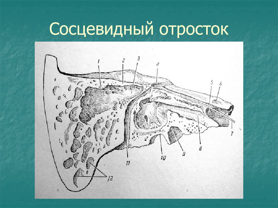 Стенки сосцевидного отростка