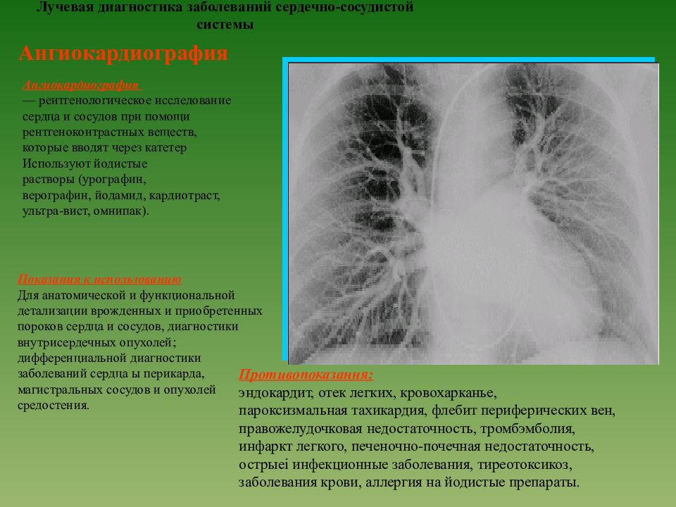 Лучевая диагностика презентация