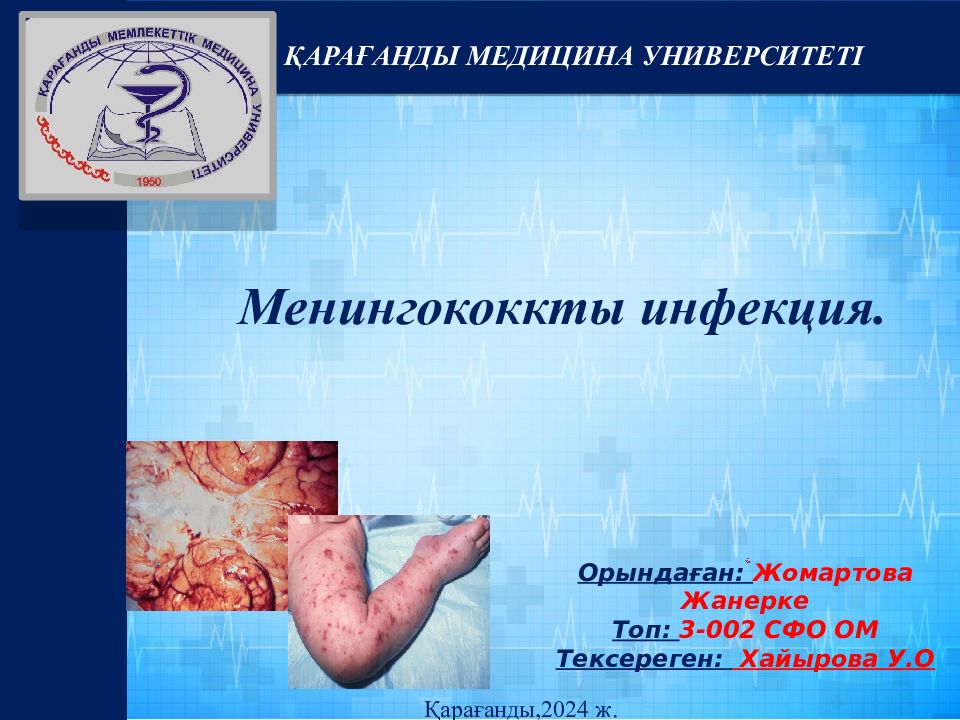 Менингококкты инфекция. ҚАРАҒАНДЫ МЕДИЦИНА УНИВЕРСИТЕТІ Орындаған: Жомартова