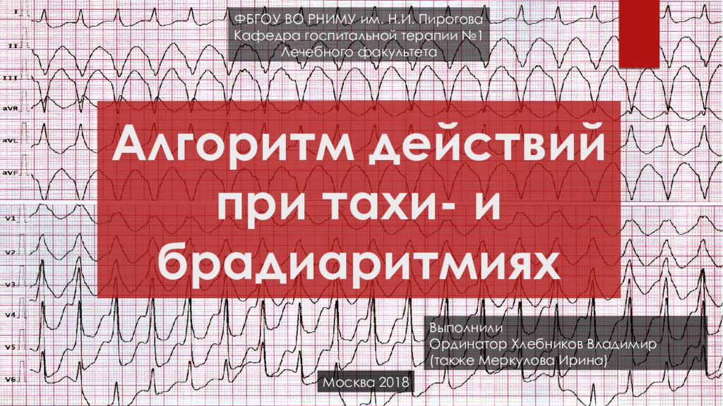 Алгоритм действий при тахи - и брадиаритмиях