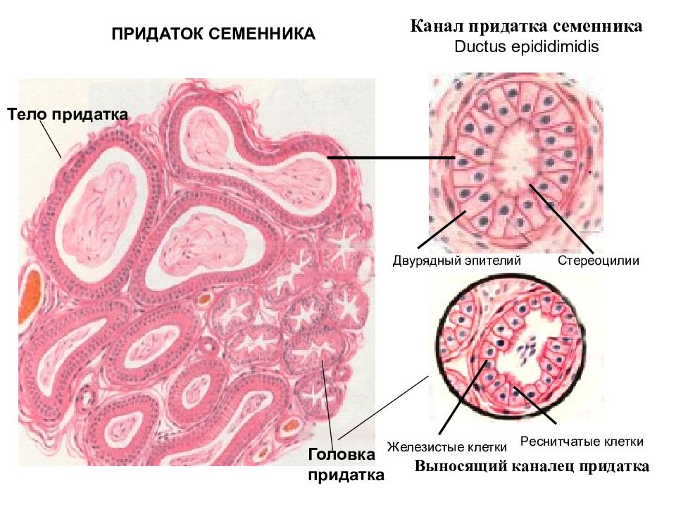 Придаток семенника фото