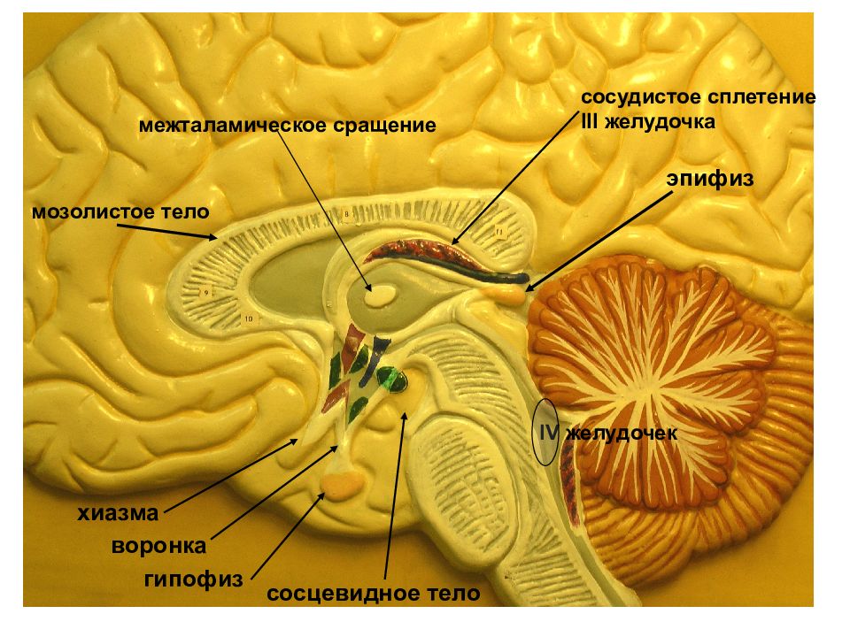 Шишковидная железа обызвествление. Межталамическое сращение таламуса. Зрительный Перекрест таламус. Сосцевидные тела головного мозга. Сосцевидное тело промежуточный мозг.