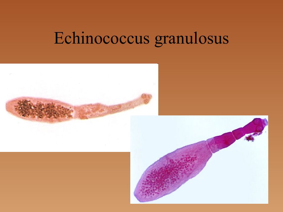 Эхинококк. Эхинококк (Echinococcus granulosus). Гидатидный эхинококкоз. . Цестодозы (эхинококкоз.