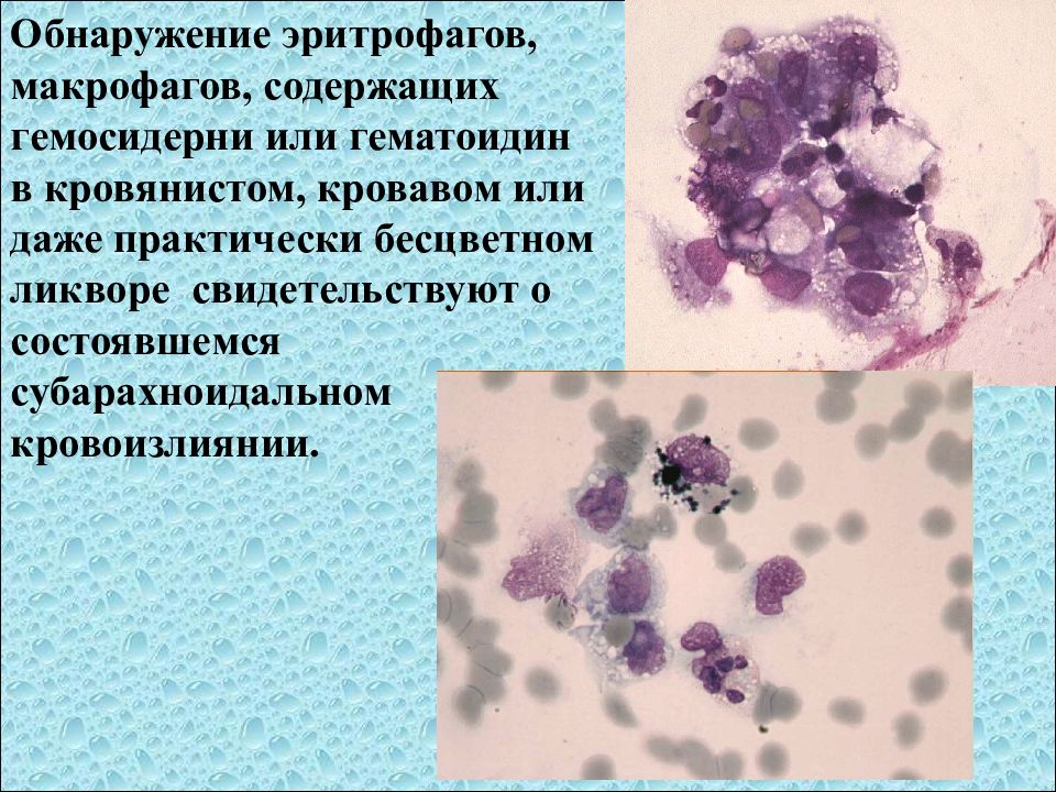 Исследование ликвора презентация