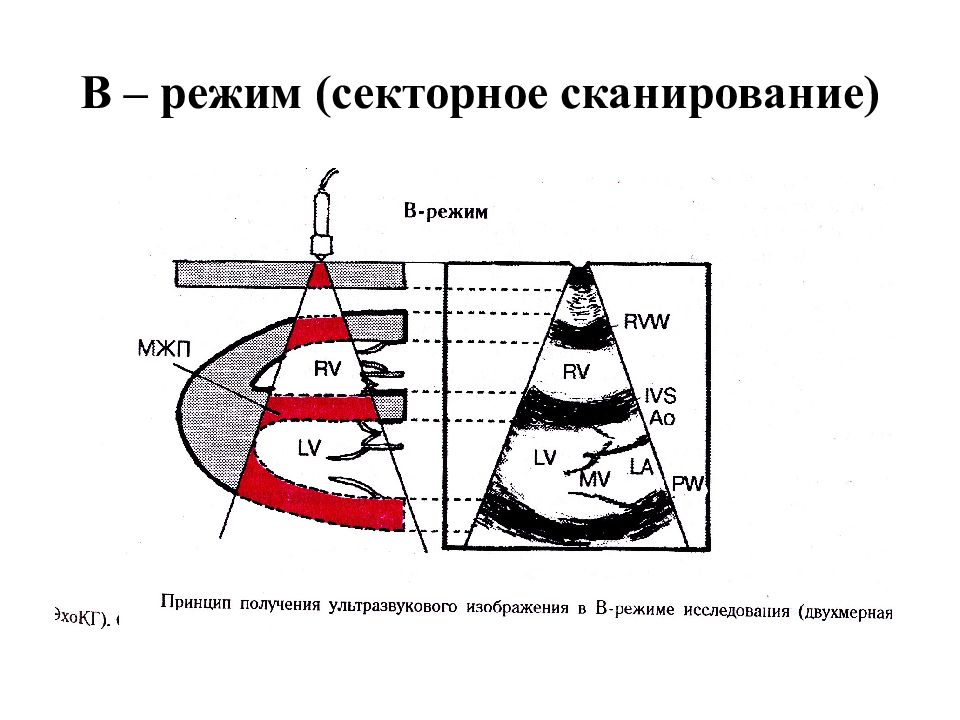 Принципы получения ультразвукового изображения сердца в трех режимах сканирования