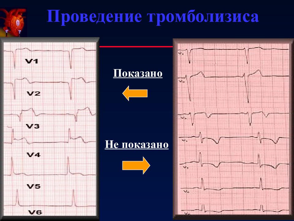 Окс картинки для презентации