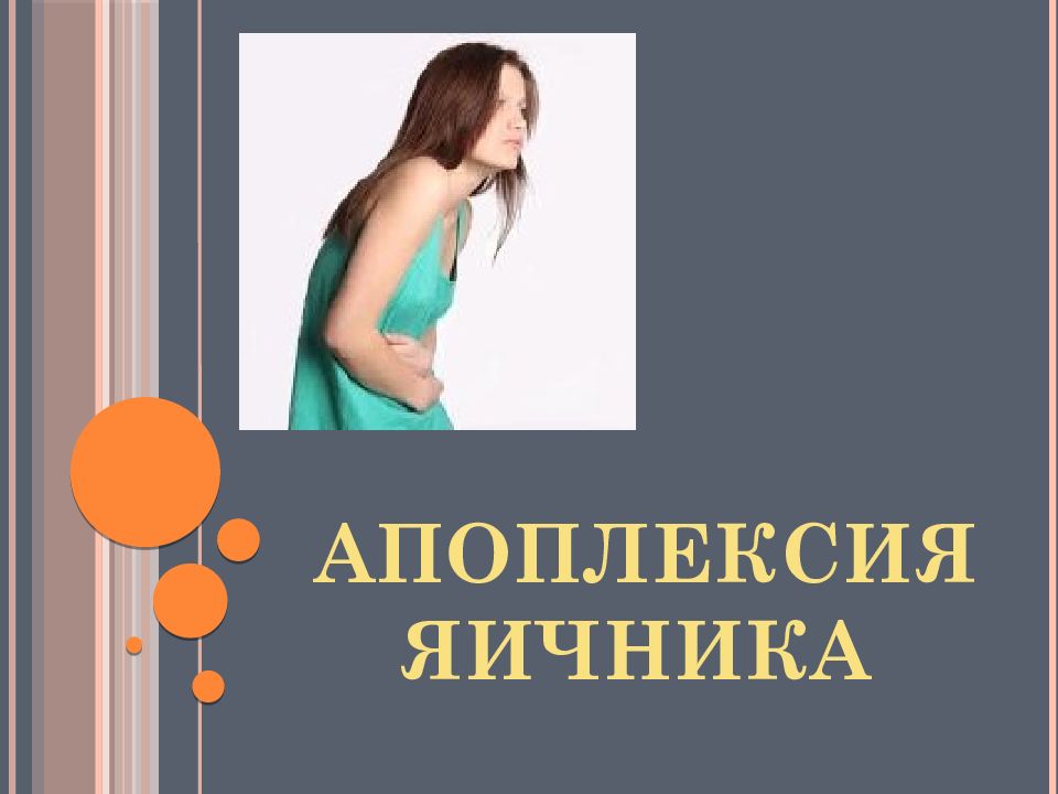 Апоплексия яичника