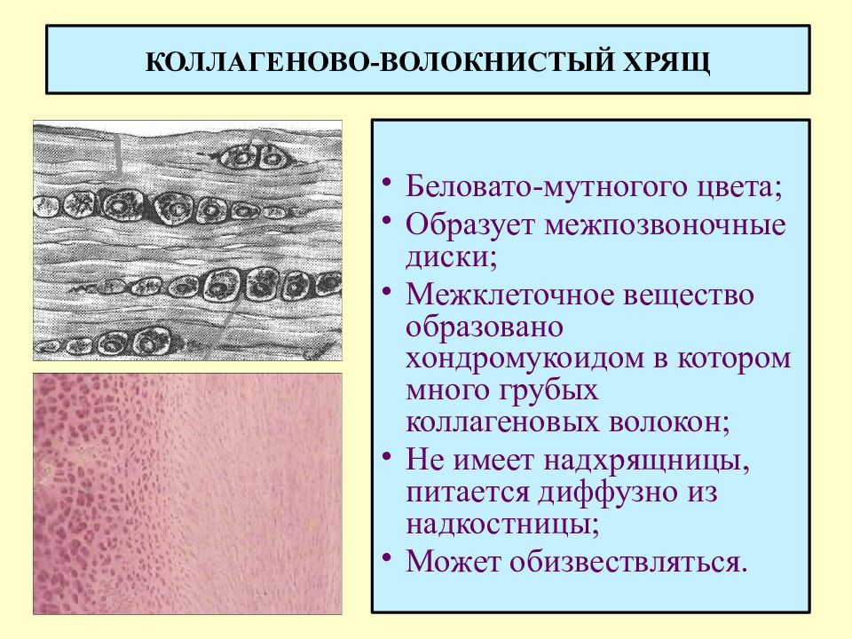 Образованное волокнами. Волокнистый хрящ образует межпозвоночные диски. Коллагеново волокнистый хрящ. Коллагеново волокнистый хрящ препарат. Коллагеновая волокнистая хрящевая ткань.