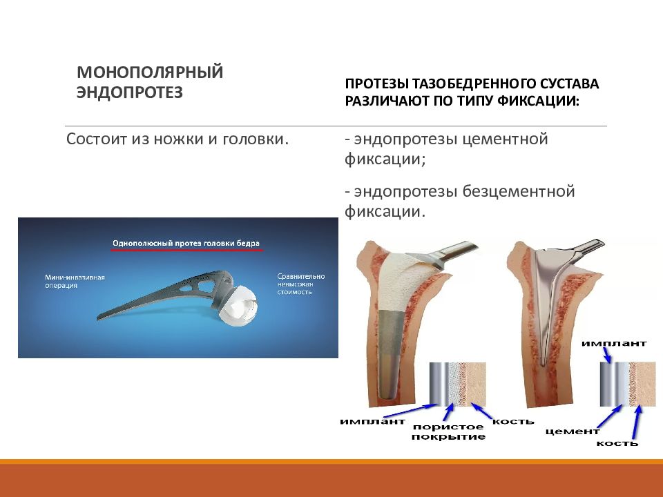 Установка эндопротеза