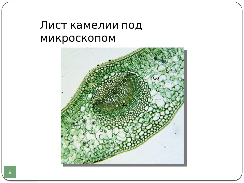 Лист под микроскопом с подписями. Поперечный разрез листа камелии. Клетки листа камелии под микроскопом. Клетки листа камелии срез. Микропрепарат внутреннее строение листа камелии.