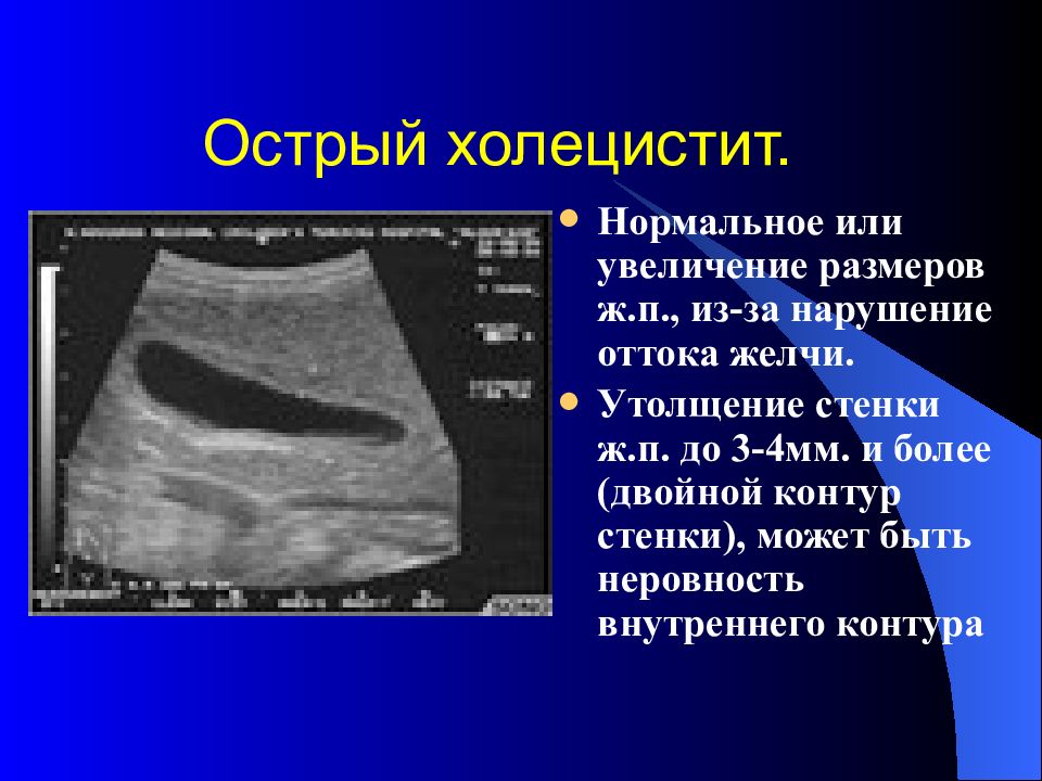 Лучевая диагностика брюшной полости презентация