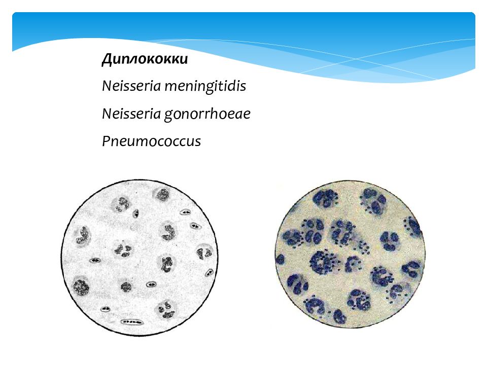 Гонококки презентация микробиология