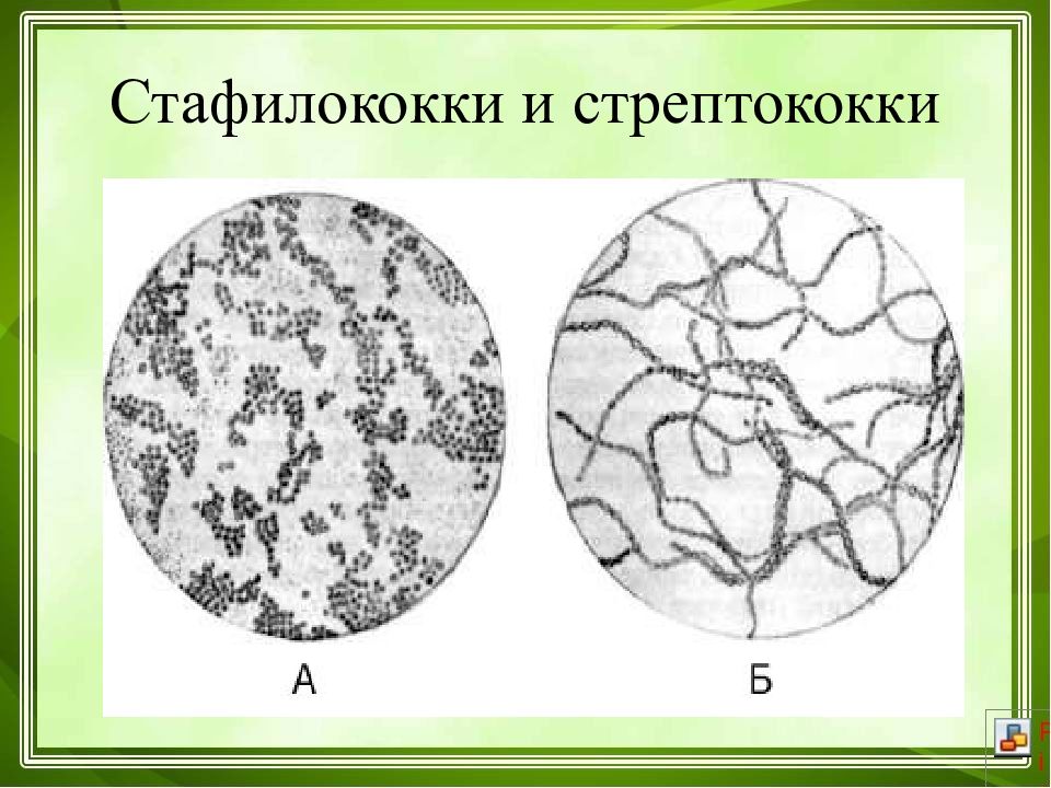 Стрептококки презентация микробиология