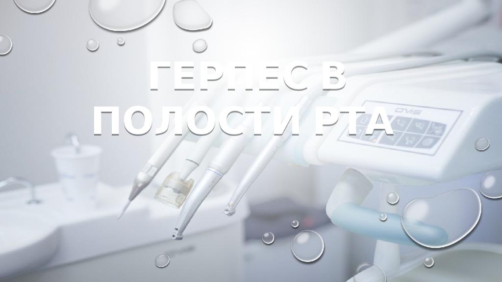 Герпес в полости рта