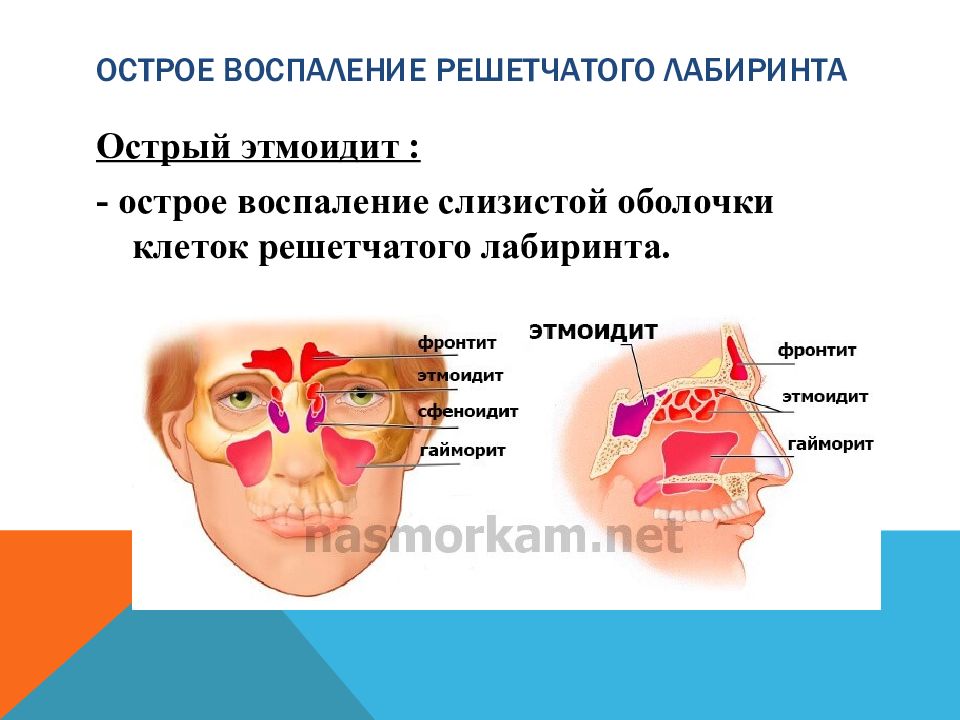 Клетки решетчатого лабиринта