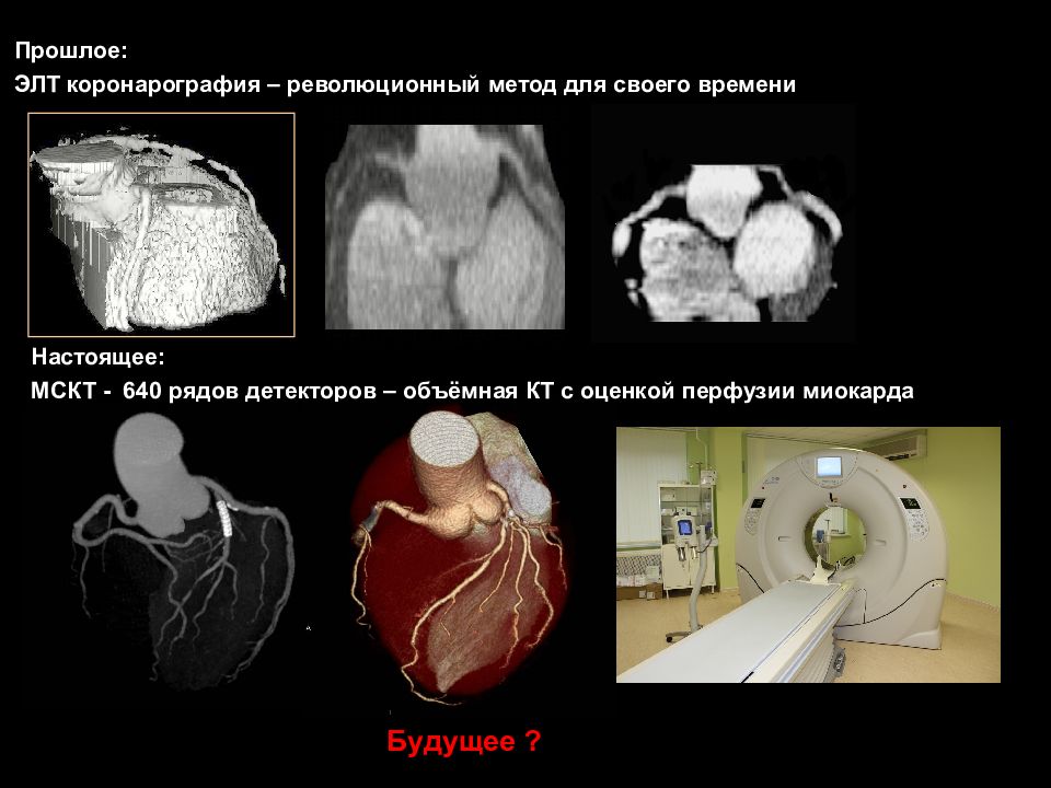 Кт скрининг коронарного кальция