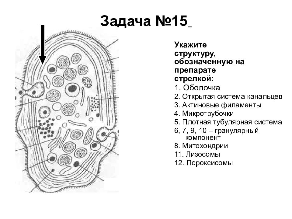 Укажите структуру. Плотная тубулярная система. Стрелками обозначена структура оистология. Staphylininae строение с обозначением. Определите препараты и обозначьте структур.