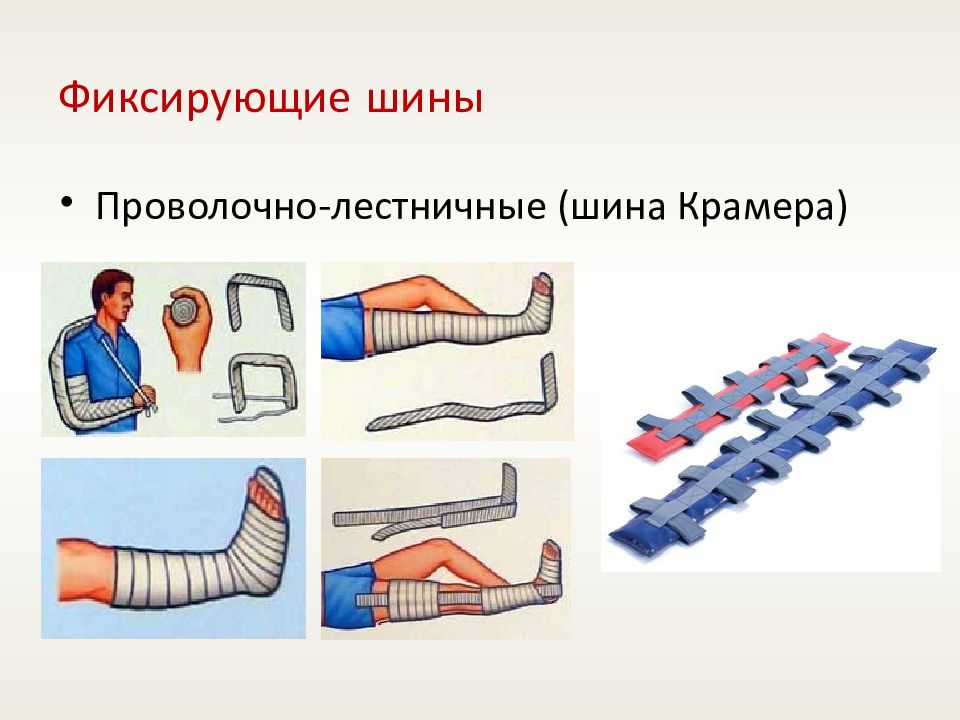 Транспортная иммобилизация при переломах конечностей